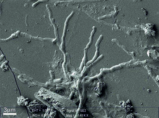 Neuroni nel cervello vetrificato