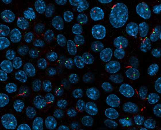 ciglia e corpi basali marcati con anticorpi fluorescenti-ft credits @CEINGE -immagine soggetta a copyright