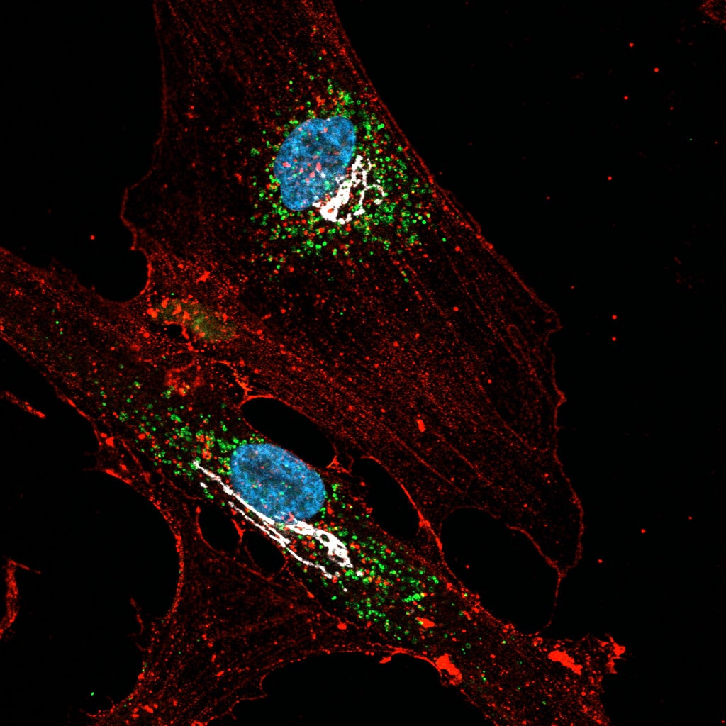 organelli cellullari e proteine motrici marcati in fluorescenza-ft credits @CEINGE -immagine soggetta a copyright