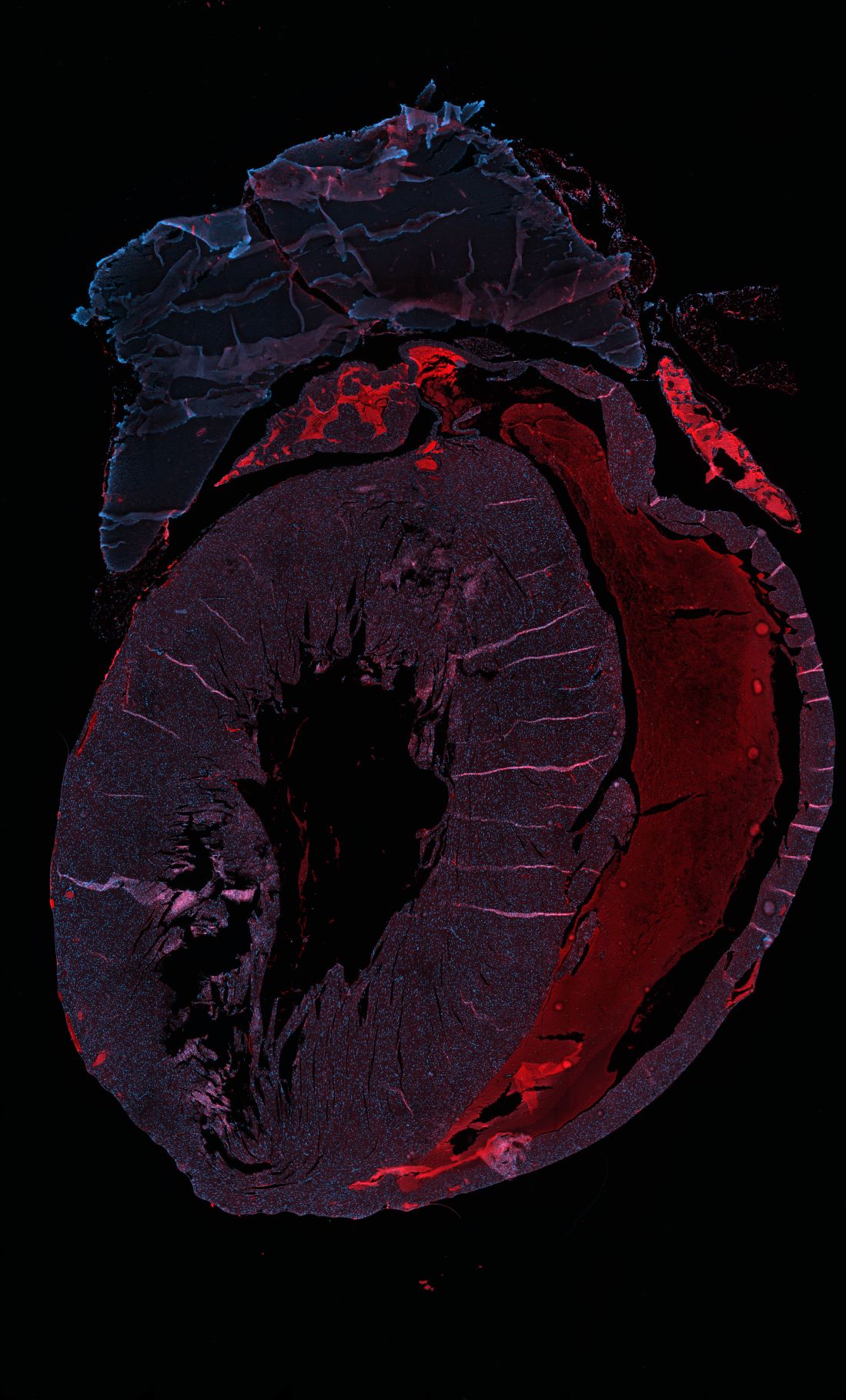 sezione di cuore con cellule marcate in fluorescenza-ft credits @CEINGE -immagine soggetta a copyright