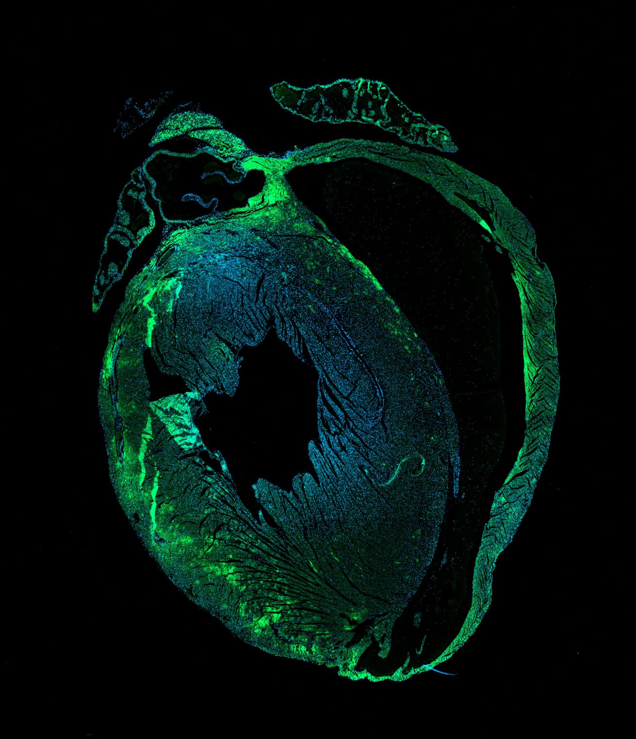 sezione di cuore con cellule marcate in fluorescenza-ft credits @CEINGE -immagine soggetta a copyright