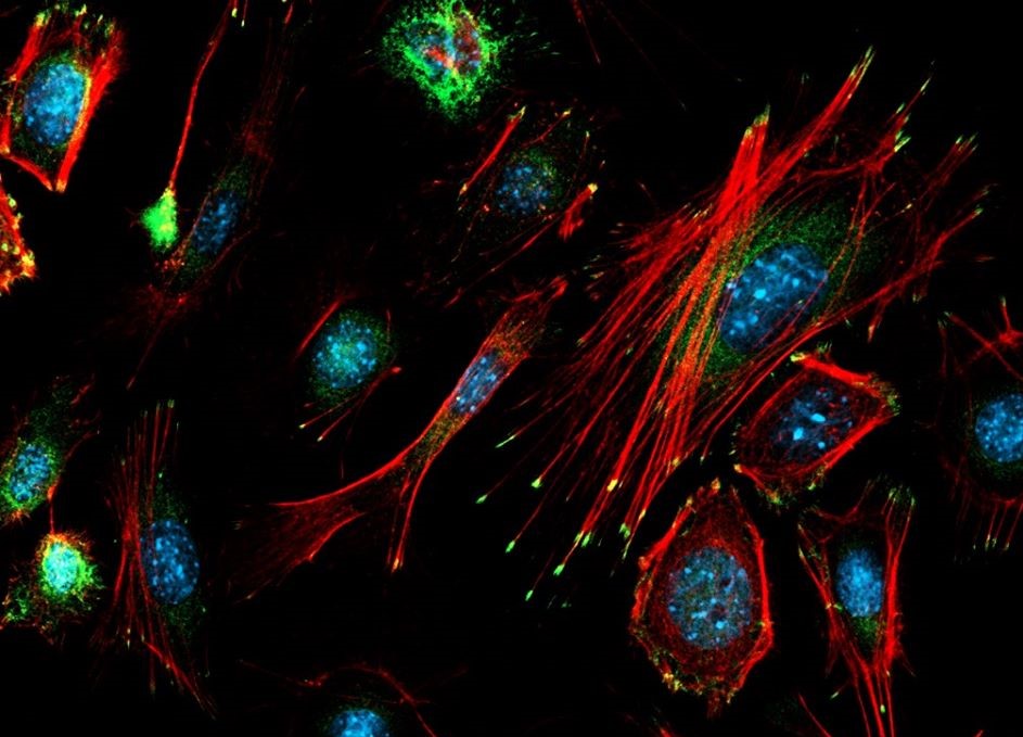 cellule epiteliali marcate con anticorpi fluorescenti -ft credits @CEINGE -immagine soggetta a copyright