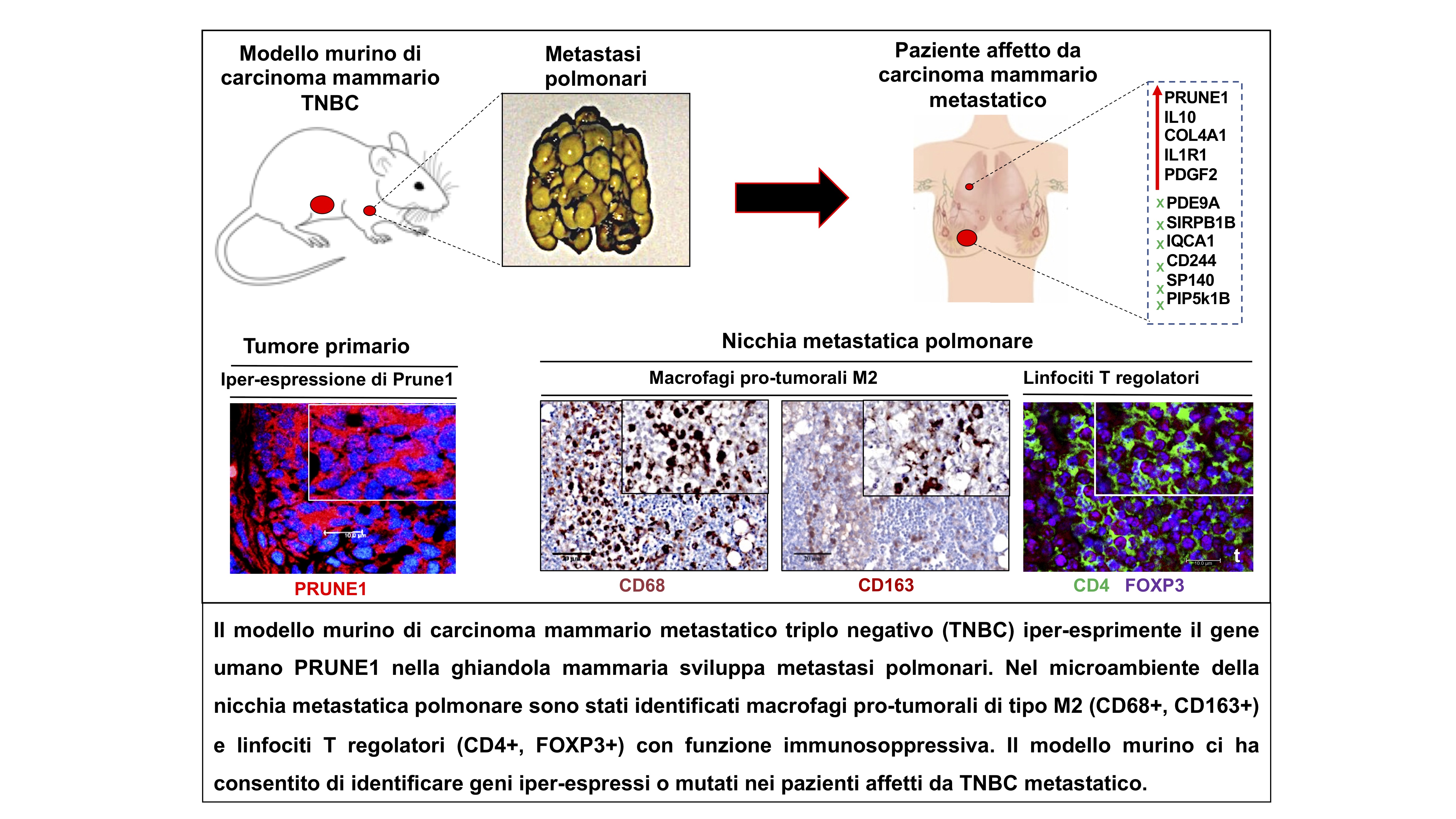 Carcinoma triplo negativo-studio di PRUNE1 -ft credits @ceinge