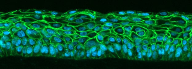 3D-culture of human skin marked with fluorescent antibodies -ft CREDITS@CEINGE