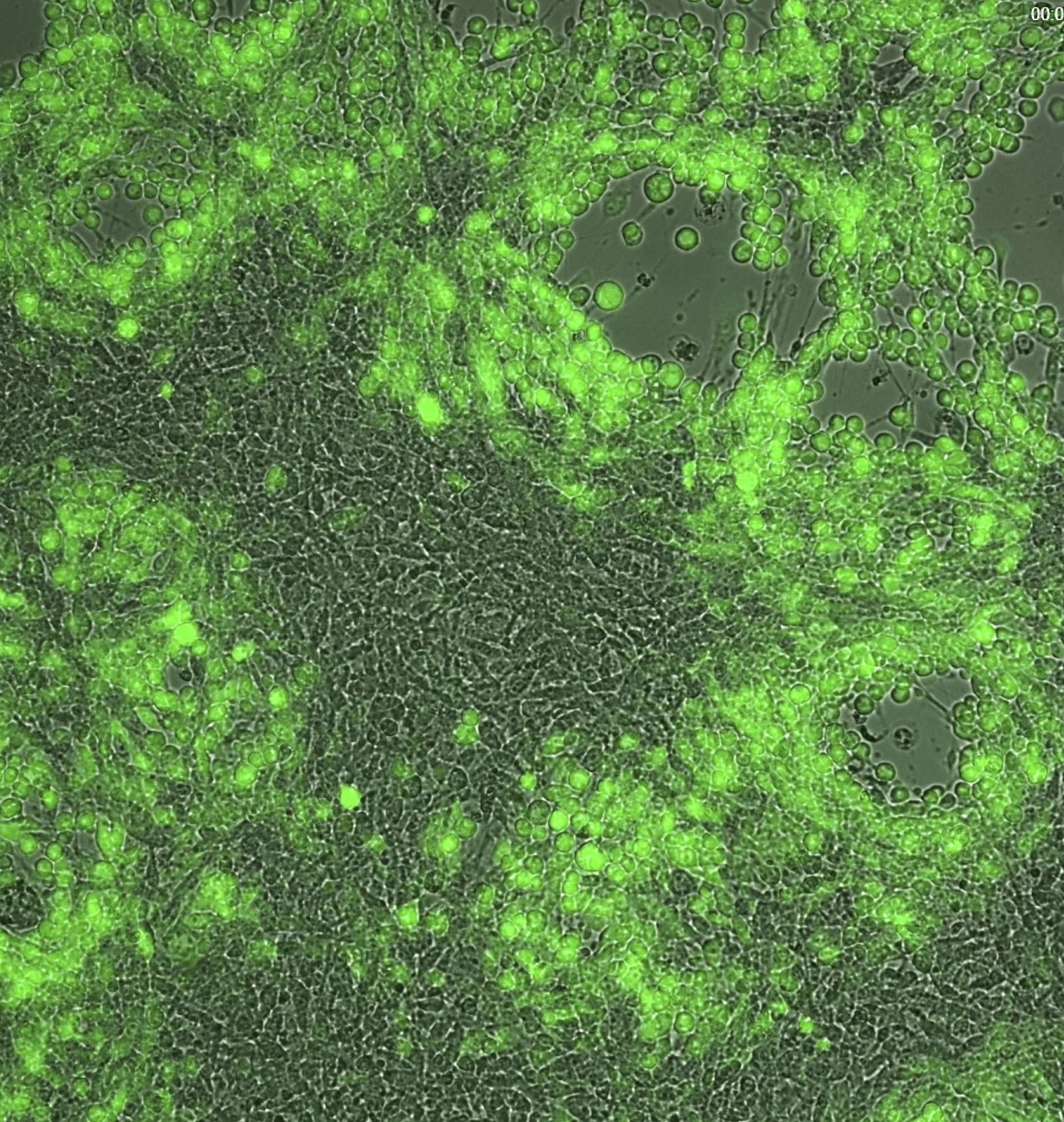 Fasi iniziali della caratterizzazione in vitro di un virus oncolitico-in verde cellule in cui il virus si sta replicando -  Ft Credits @CEINGE