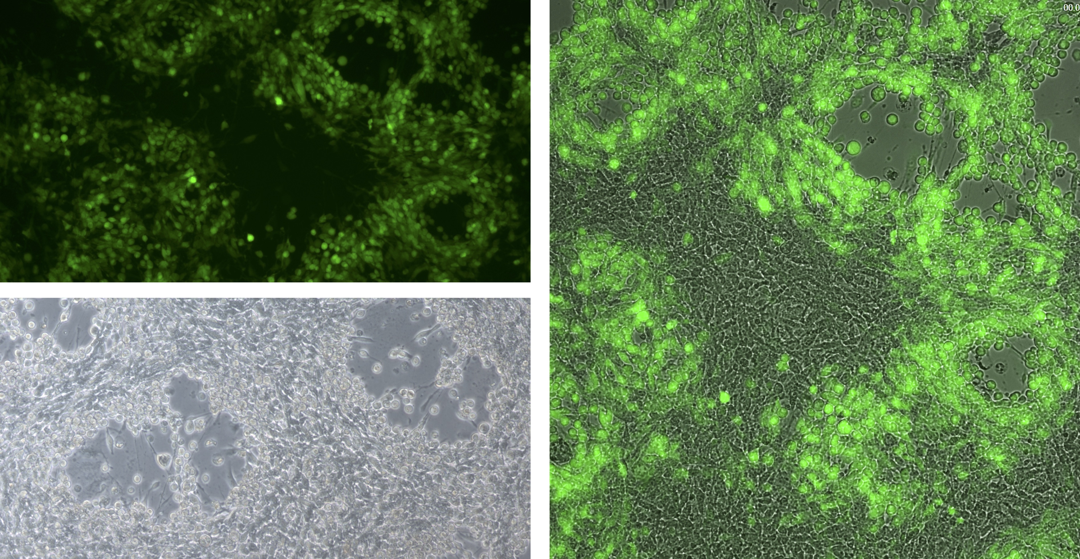 Fasi iniziali della caratterizzazione in vitro di un virus oncolitico-Ft Credits @CEINGE