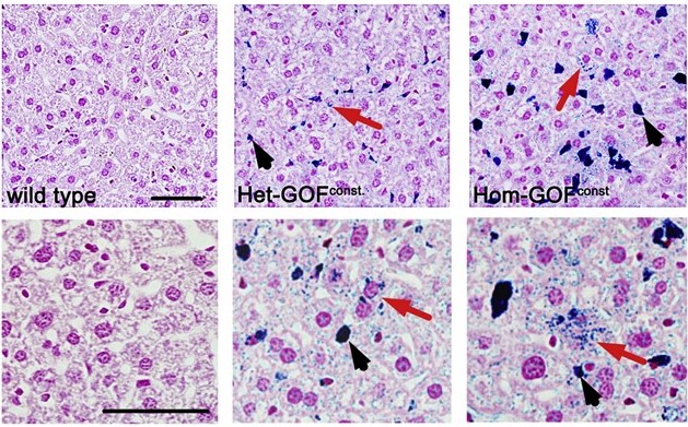 Colorazione di Perls su tessuti di fegato del topo wild type a sinistra, del topo eterozigote per mutazione in PIEZO1 al centro, e del topo omozigote  er mutazione in PIEZO1. Il colore blu indica l’accumulo di ferro negli epatociti (frecce rosse) e nelle cellule di Kupffer cells (frecce rosse).  Figura 1A del lavoro di Ma S, …., Andolfo I, Patapoutian A. A role of PIEZO1 in iron metabolism in mice and humans. Cell. 2021 Feb 18;184(4):969-982.e13