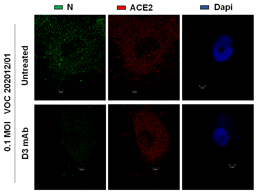 immagine in immunofluorescenza di cellule umane infettate in vitro con la variante inglese del virus SARS-CoV2 in assenza (pannelli in alto) o in presenza (pannelli in basso) del nuovo anticorpo anti- Spike. In verde “N (nucleocapsid)”, una proteina del virus SARS-CoV2- ft credits @ceinge