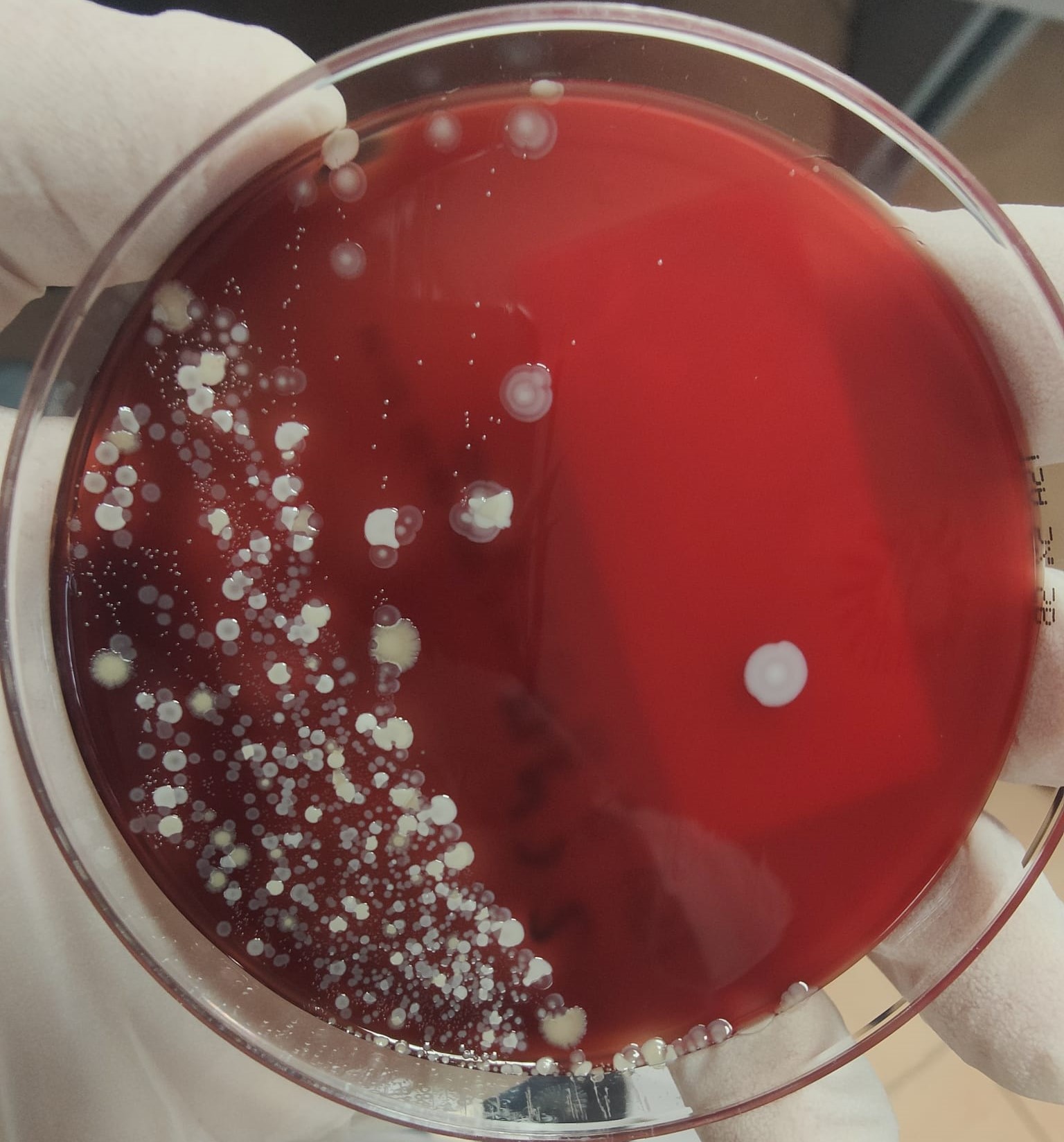 campione microbiologico misto
